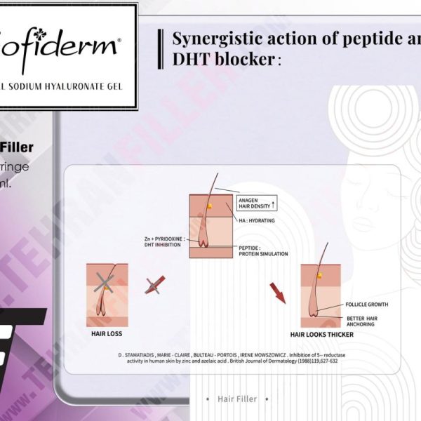 هیرفیلر صوفیدرم 1ml