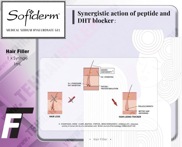 هیرفیلر صوفیدرم 1ml - Image 2